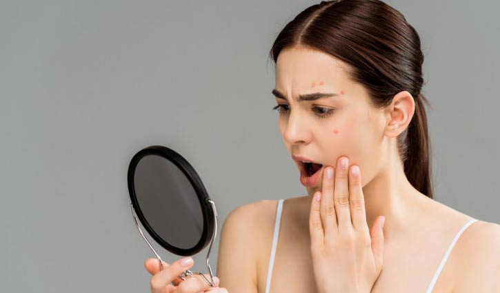 তৈলাক্ত ত্বক থেকে মুক্তি