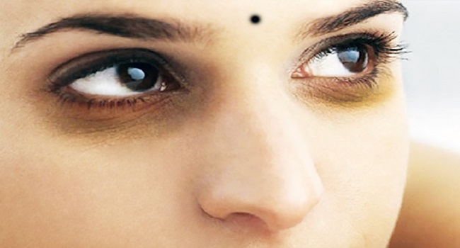 চোখের নিচের কালি ও ব্রণের দাগ