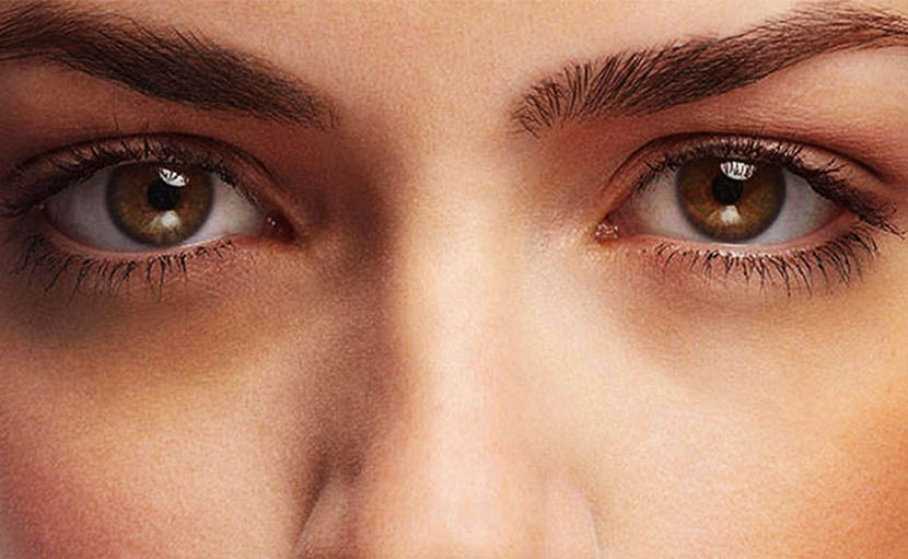 চোখের নিচে ডার্ক সার্কেল